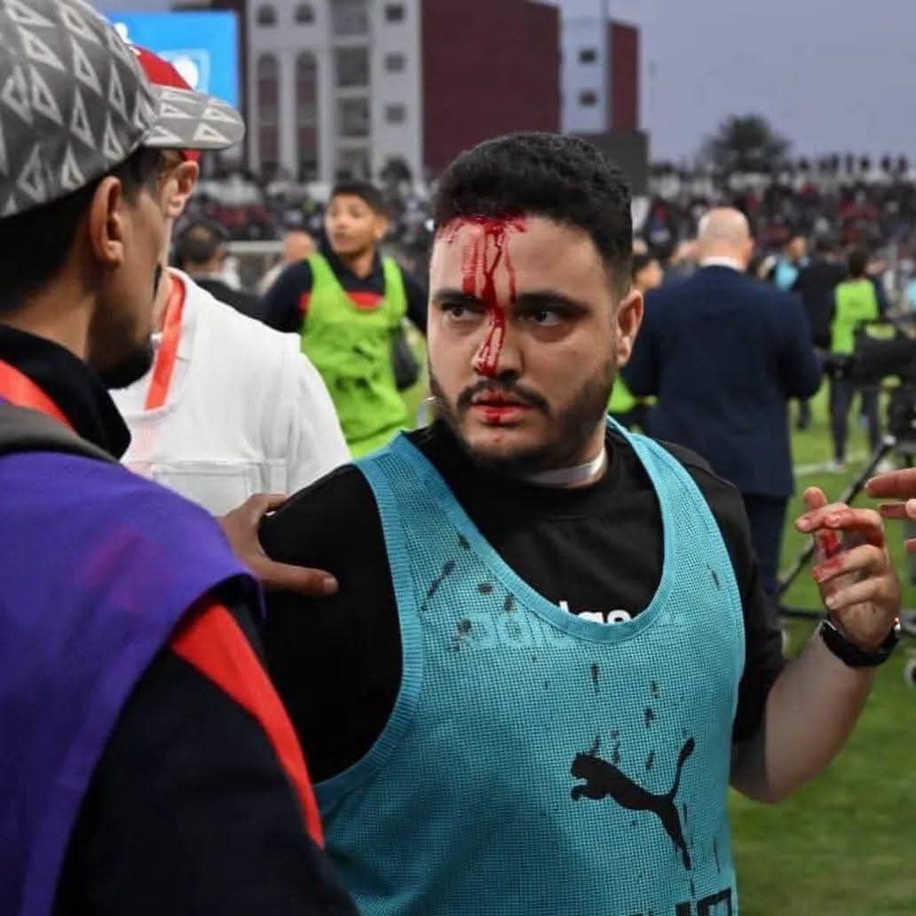 دماء بملعب مباراة أولمبيك آسفي ضد اتحاد الجزائر