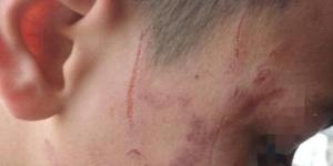 داخل مدرسة دار السلام بسوهاج.. معلمة تضرب تلميذًا بخرطوم الأنبوبة والتعليم تفتح تحقيقًا عاجلًا