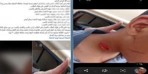 خدوش وجرح قطعي بالرقبة.. 7 طلاب يعتدون على زميلهم بزجاجة فارغة في الشرقية
