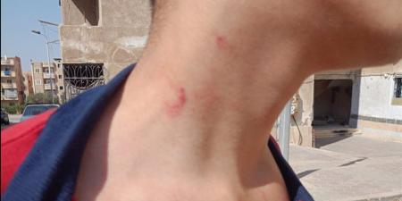 والدة
      طالب
      تستغيث
      بوزير
      التعليم:
      زميل
      ابني
      حاول
      إلقائه
      من
      الدور
      الثالث
      في
      المدرسة