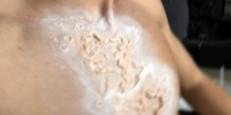 بشكل
      مُخيف
      جداً..
      ابن
      الفنان
      راغب
      علامة
      يحتفل
      بـ
      "الهالويين"
      على
      طريقته
      (صور)