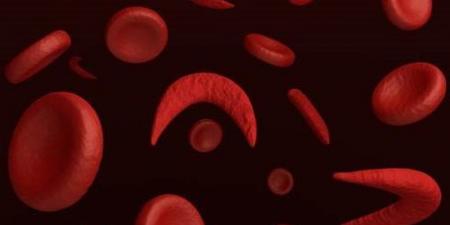 فحص 3.5 مليون طالب للكشف المبكر عن الأنيميا والسمنة والتقزم بالمدارس