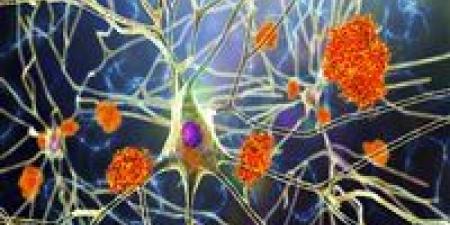 من الفياجرا إلى لقاح الهربس.. أدوية غريبة تقاتل ألزهايمر!