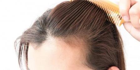 عادة سيئة تتسبب في تساقط الشعر وظهور الشيب مبكرا