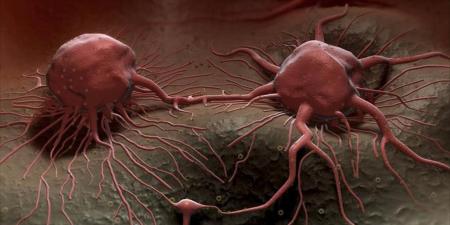 نصائح مثبتة علميًا للتقليل من مخاطر الإصابة بالسرطان