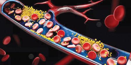 "وقود القلب".. 10 أطعمة خارقة تخفض الكوليسترول وتحمي من الجلطات