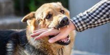 بخطوات بسيطة.. كيف تحمي نفسك فور التعرض لعضة كلب؟