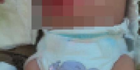 الطفل عمر أبو يوسف.. 9 أشهر من الألم والمعاناة وسط نقص حاد في العلاج بغزة