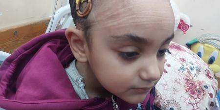 طفولة تحت النار.. سارة تصارع فقدان البصر بعد إصابتها برصاصة فى الرأس بغزة