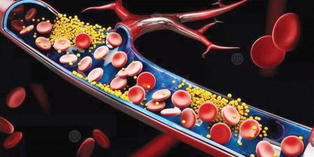 سرّ بسيط لصحة القلب.. أطعمة تخفض الكوليسترول خلال أسابيع