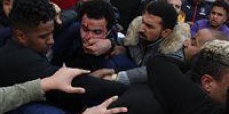 خرطوش داخل صيدلية.. اعتداء دموي على شقيقين بالهرم بعد رفض بيع دواء