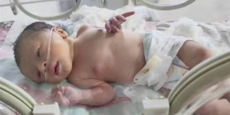 على خُطى «حكاية نرجس».. جدل واسع حول واقعة خطف رضيعة داخل مستشفى الحسين الجامعي (فيديو)