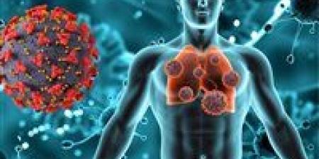 "مبقاش مميت ".. المعهد القومي للأورام يكشف ثورة علاجية غير مسبوقة لعلاج السرطان