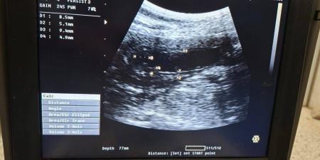 مستشفى الطب البيطري بجامعة قنا تستقبل حالة نادرة لكلبة جيرمان شيبرد تعاني من نزيف بالبول وخمول مزمن