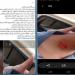 خدوش وجرح قطعي بالرقبة.. 7 طلاب يعتدون على زميلهم بزجاجة فارغة في الشرقية