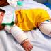 الرضيع محمد الخطيب فقد أمه وبترت قدمه فى الحرب وينتظر فرصة العلاج خارج غزة
