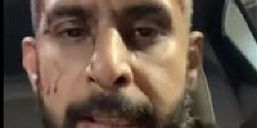 خرمولي
      جسمي..
      الأمن
      يفحص
      فيديو
      التعدي
      على
      سائق
      بالصحراوي
      في
      الجيزة