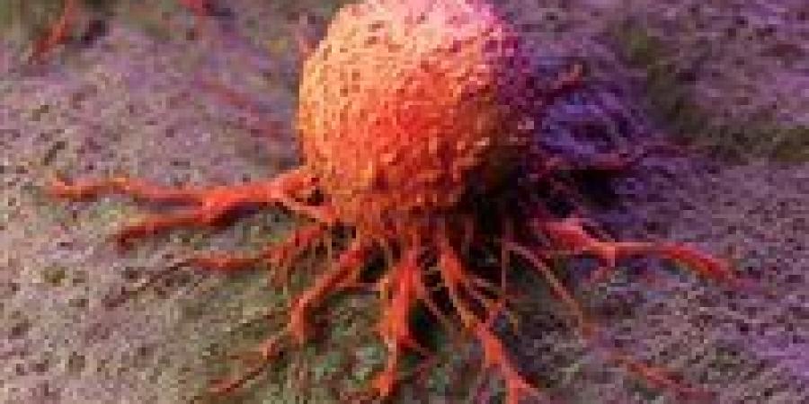 علامة
      خفية
      في
      الأظافر
      قد
      تكشف
      سرطان
      الرئة
      مبكرًا..
      لا
      تتجاهلها
      أبداً!