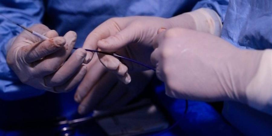 تحت مظلة التأمين الصحي الشامل.. نجاح عملية نادرة لاستئصال ورم 6 كجم من جدار الصدر ببورسعيد