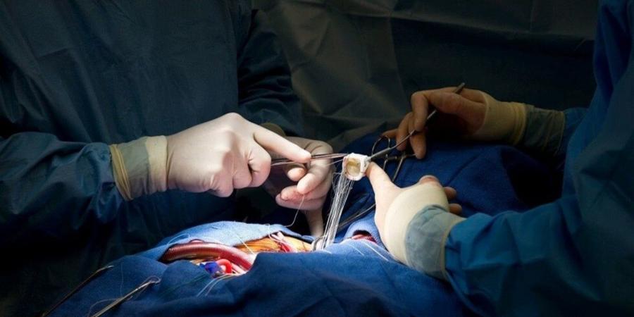 علماء يحددون آليات رفض جسم الإنسان لكلية خنزير معدل وراثيا