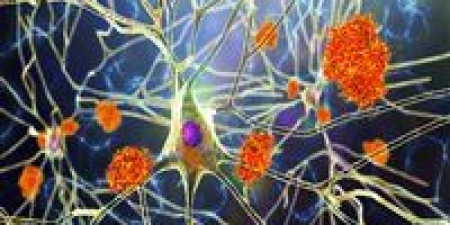 من الفياجرا إلى لقاح الهربس.. أدوية غريبة تقاتل ألزهايمر!