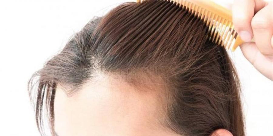 عادة سيئة تتسبب في تساقط الشعر وظهور الشيب مبكرا