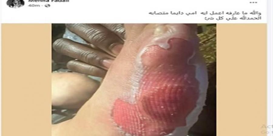 الحمدلله على كل شئ.. منة فضالي تعلن إصابة والدتها في قدمها