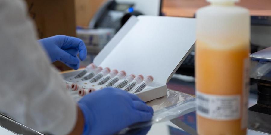 مصر تحقق الاكتفاء الذاتى من البلازما.. وجريفولز إيجيبت تحصل على اعتماد EMA