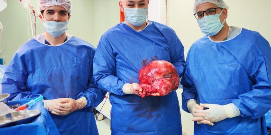 فريق طبي بمستشفى التأمين الصحي ببني سويف ينجح في استئصال ورم سرطاني ضخم