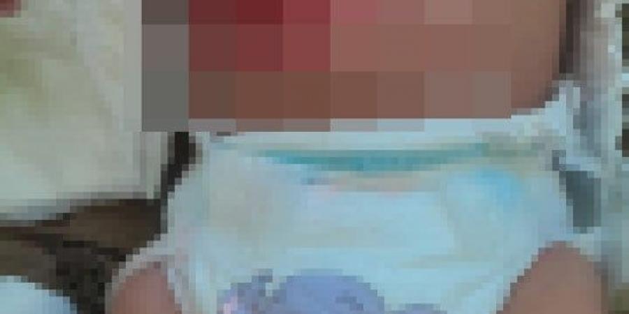 الطفل عمر أبو يوسف.. 9 أشهر من الألم والمعاناة وسط نقص حاد في العلاج بغزة