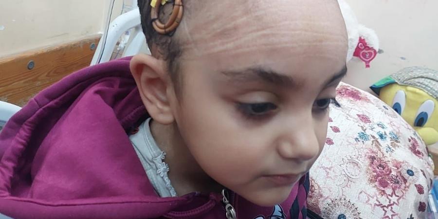 طفولة تحت النار.. سارة تصارع فقدان البصر بعد إصابتها برصاصة فى الرأس بغزة