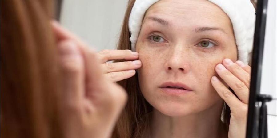 علامات نقص الفيتامينات في الجسم.. إشارات تحذيرية لا يجب تجاهلها