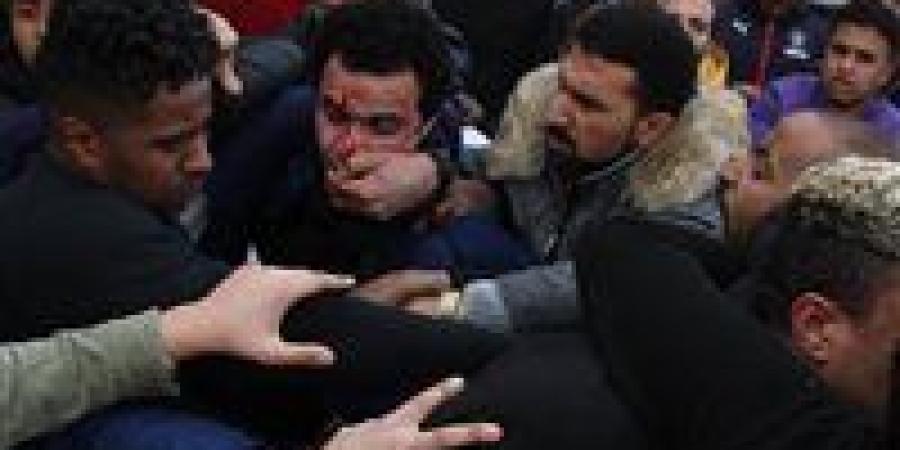 خرطوش داخل صيدلية.. اعتداء دموي على شقيقين بالهرم بعد رفض بيع دواء