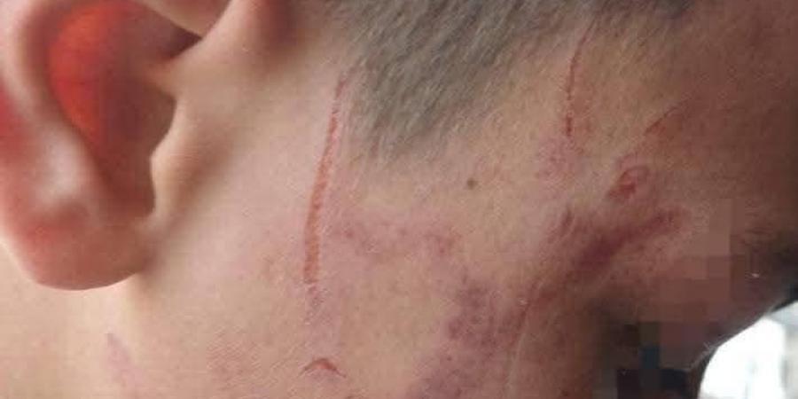 داخل مدرسة دار السلام بسوهاج.. معلمة تضرب تلميذًا بخرطوم الأنبوبة والتعليم تفتح تحقيقًا عاجلًا