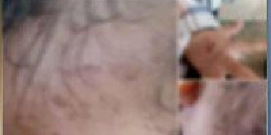 شخص يتهم طليقته ووالدتها بتعذيب نجلهما في الشرقية.. والداخلية تكشف الحقيقة